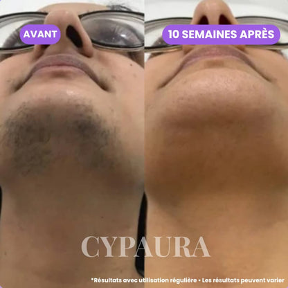 Sérum Botanique Anti-Repousse | Cypaura™