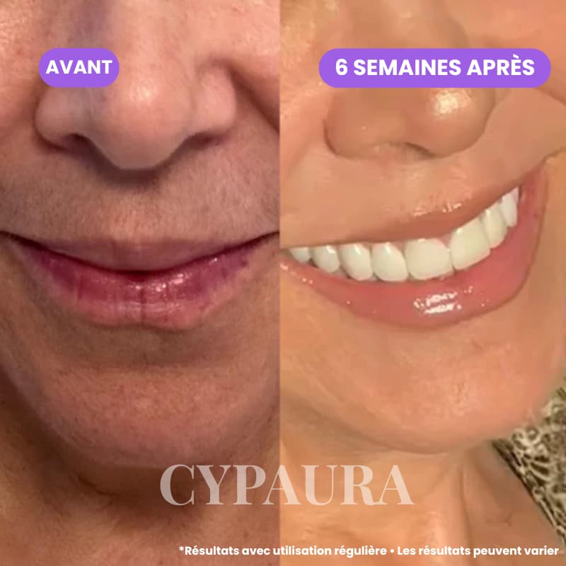 Sérum Botanique Anti-Repousse | Cypaura™