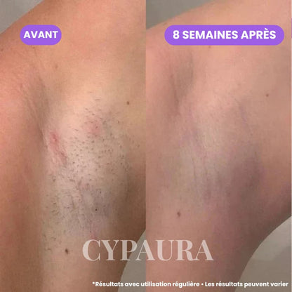 Sérum Botanique Anti-Repousse | Cypaura™