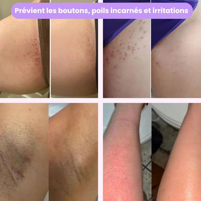 Zoom lames hypoallergéniques GlideSmooth 2.0 - Acier inoxydable qualité