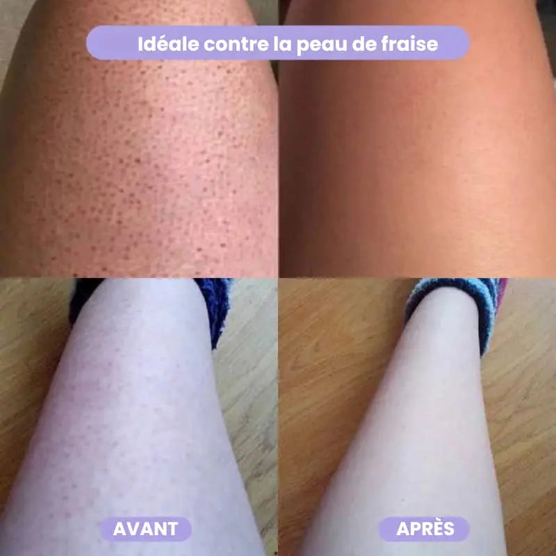 Avant/Après jambes - Épilation efficace gomme Crystal peau parfaitement lisse