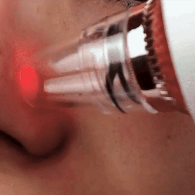 vidéo LumiDerm Pro+ Cypaura blanc avec embout de traitement sur le visage