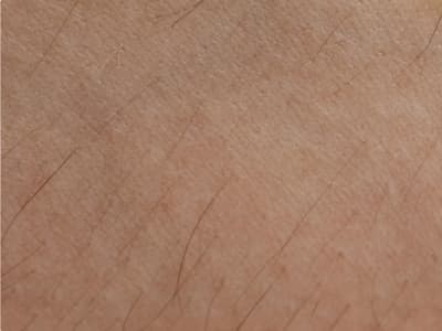 Résultats visibles après 1 mois d'application quotidienne de l'huile Cypaura